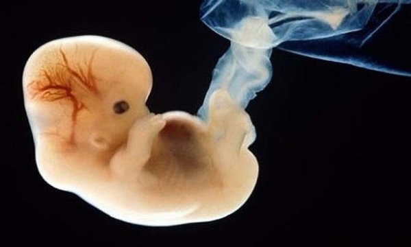 Поразительно: фотографии ребенка в утробе матери. ФОТО